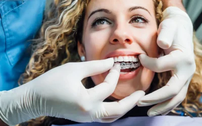 The Benefits of Clear Aligners for Adults in Redmond, OR