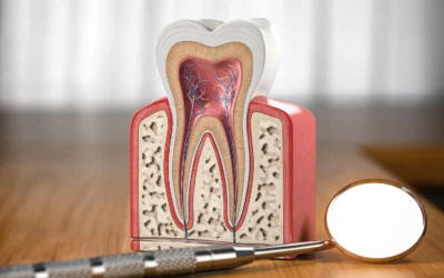Root Canals: Separating Painful Myths from Modern, Gentle Reality