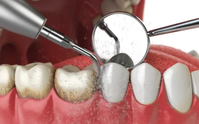 The Precision Cleaning: How Comprehensive Exams Protect Your Systemic Health